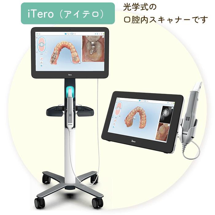 口腔内スキャナiTero