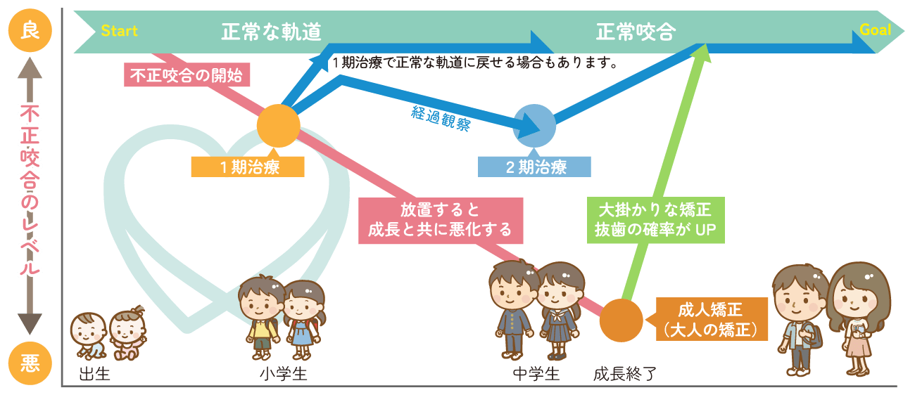 小児矯正歯科の治療の流れ