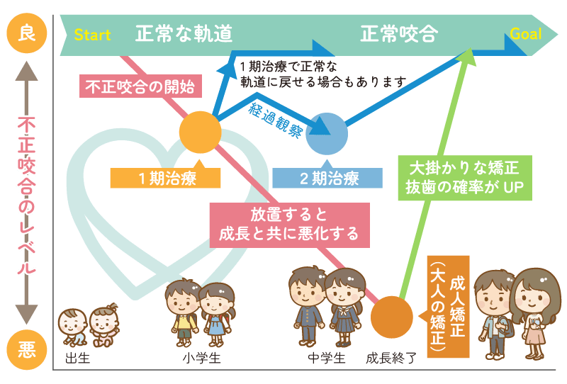 小児矯正歯科の治療の流れ