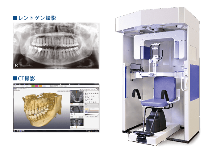 歯科用CT