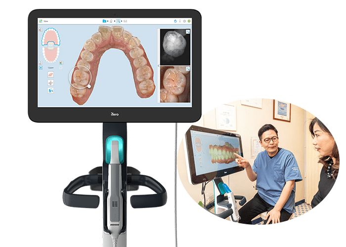 口腔内スキャナー