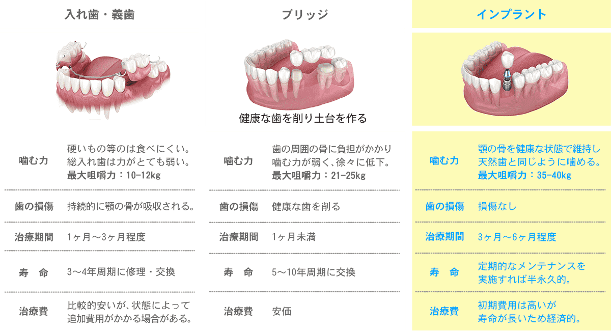 従来の治療とインプラントの違い