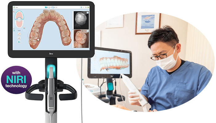 的確な診査診断、光学スキャナーで負担を少なく